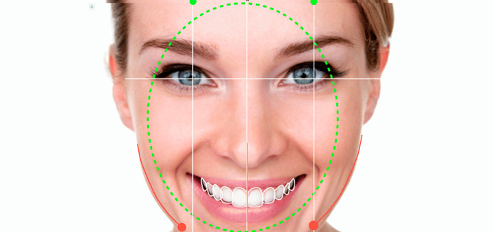 diseno-de-sonrisa-y-procedimiento-beneficios