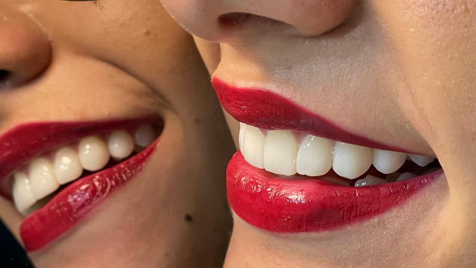 dientes